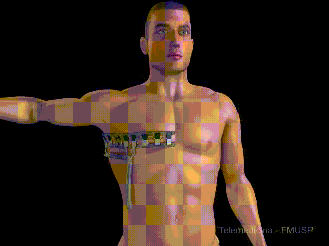 electrodes aplication